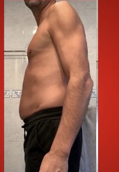 Horacio antes